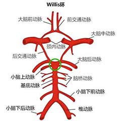 經(jīng)顱多普勒（TCD）可檢測的顱內(nèi)動脈大盤點！