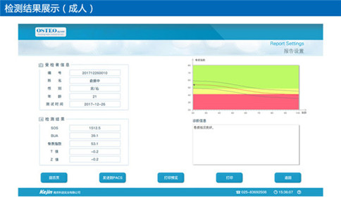 骨密度檢測儀得出的數(shù)據(jù)正常值是多少