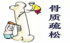 什么因素可能導(dǎo)致骨密度癥?骨密度儀廠家進行介紹