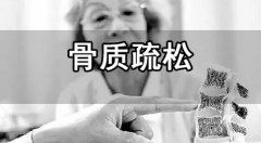 骨密度測量的時間和方法介紹