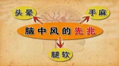 腦中風(fēng)的前兆早知道 經(jīng)顱多普勒幫助檢查腦血管疾病