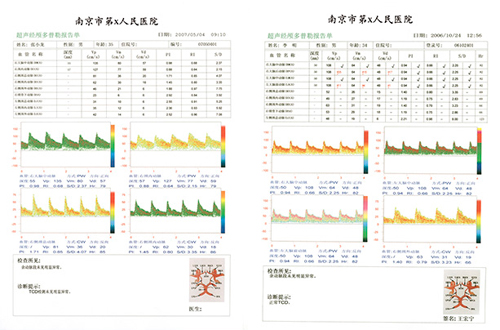 TDC檢驗(yàn)單